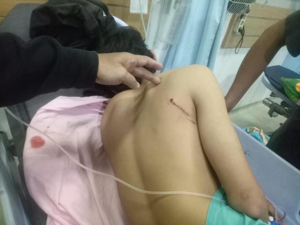 Usai Pasang Spanduk HUT RI Ke-79 Riski Pohan Jadi Korban Penembakan&nbsp;OTK